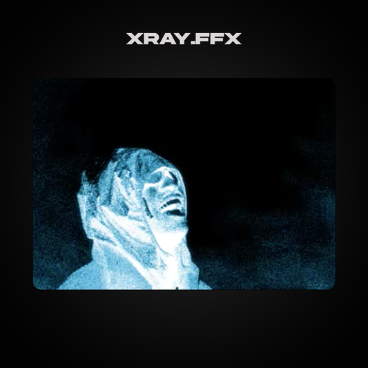 X-RAY